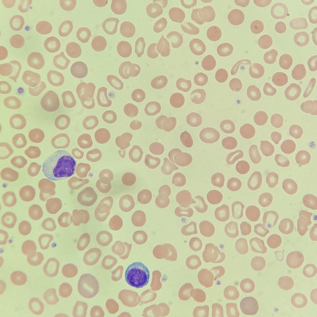 Spherocytes, red blood cell morphology