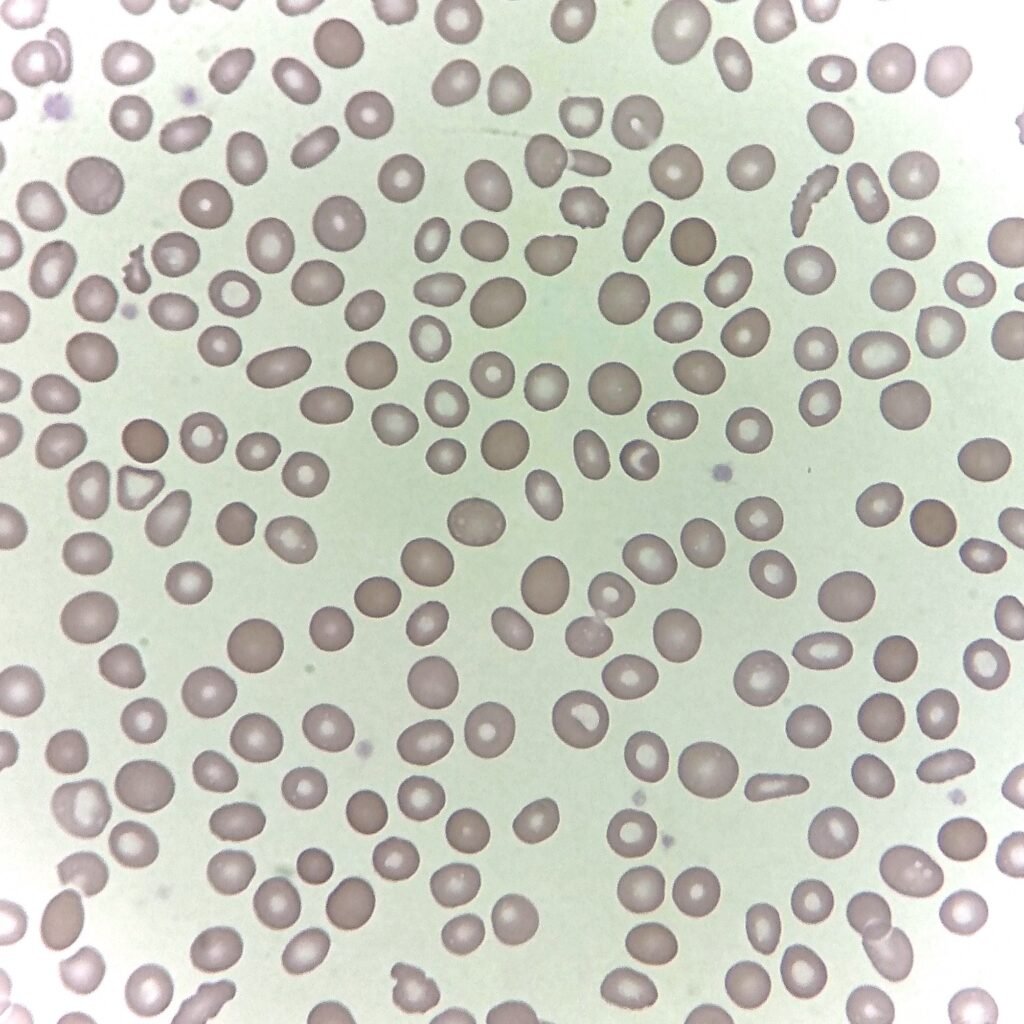 spherocytes