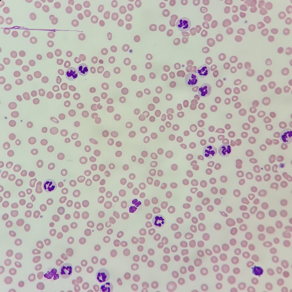spherocytes