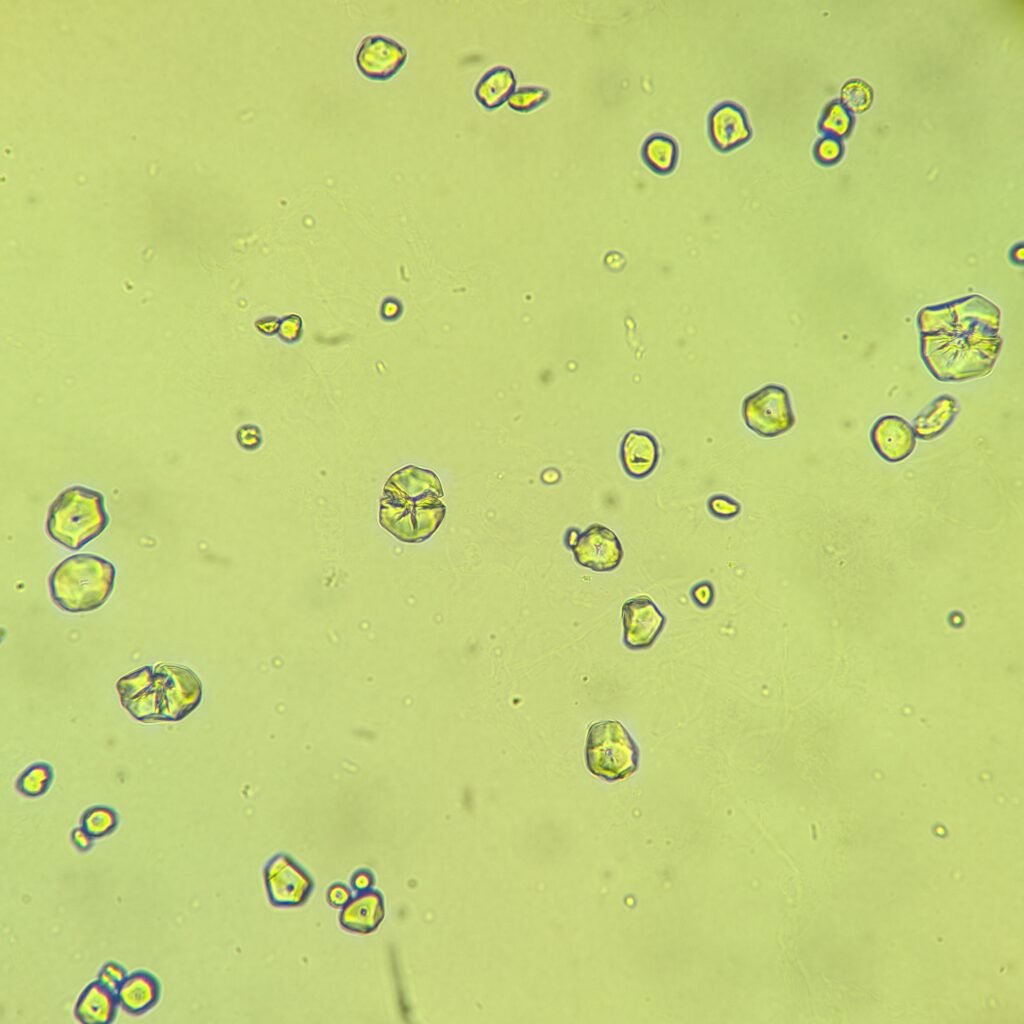 Starch Granules in Urine