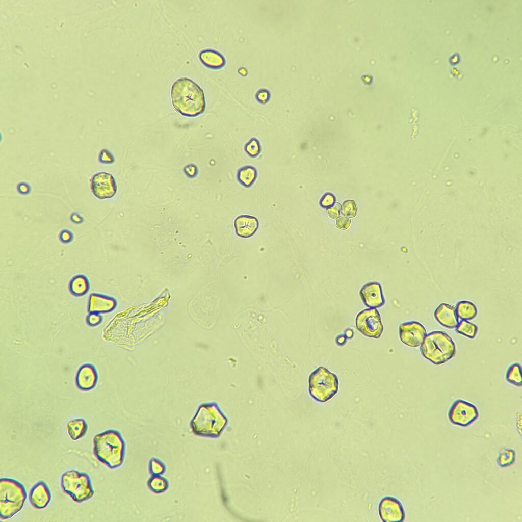 Starch Granules in Urine
