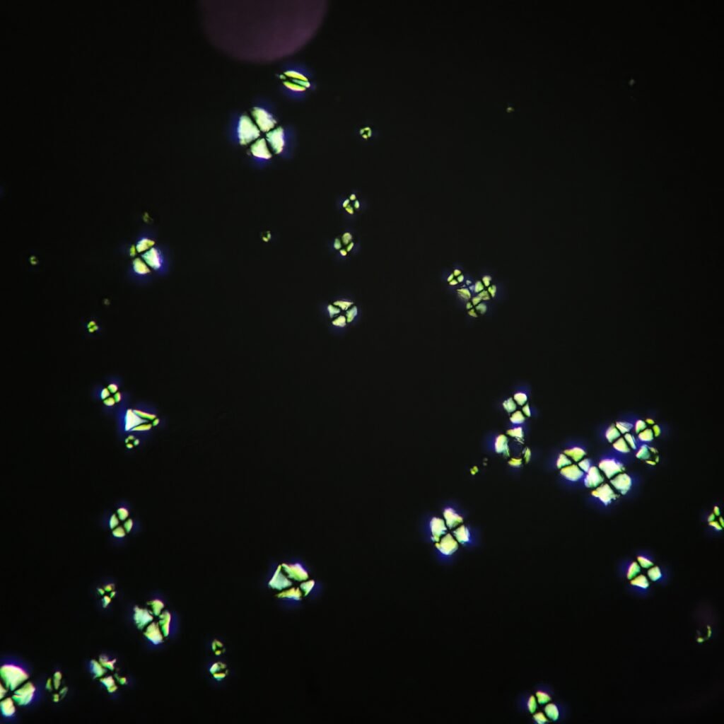 Starch Granules in Urine, Polarized