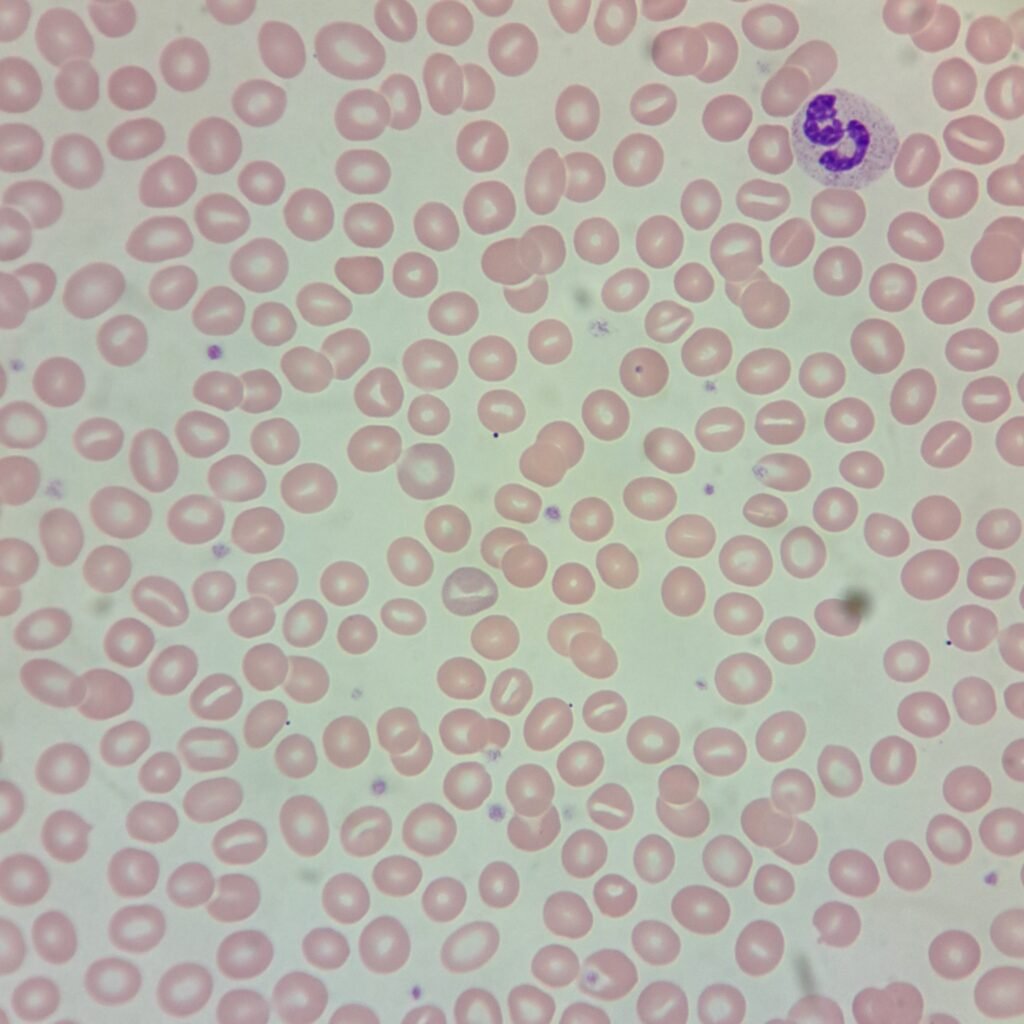 Stomatocytes