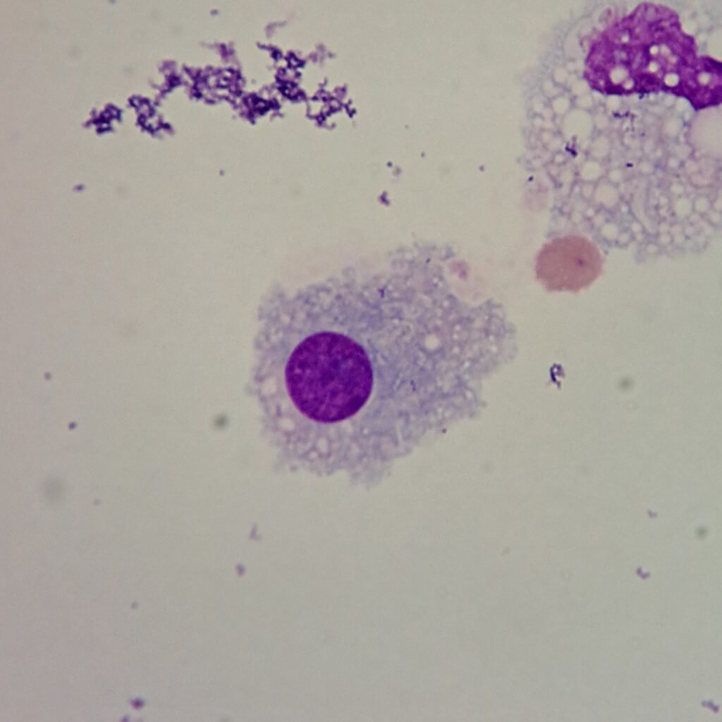 synovial lining cell (synoviocyte)