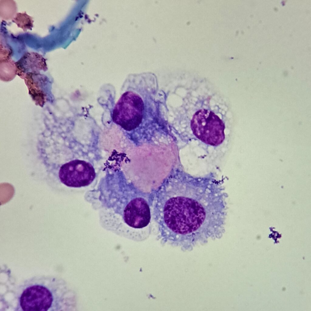 synovial lining cell (synoviocyte)