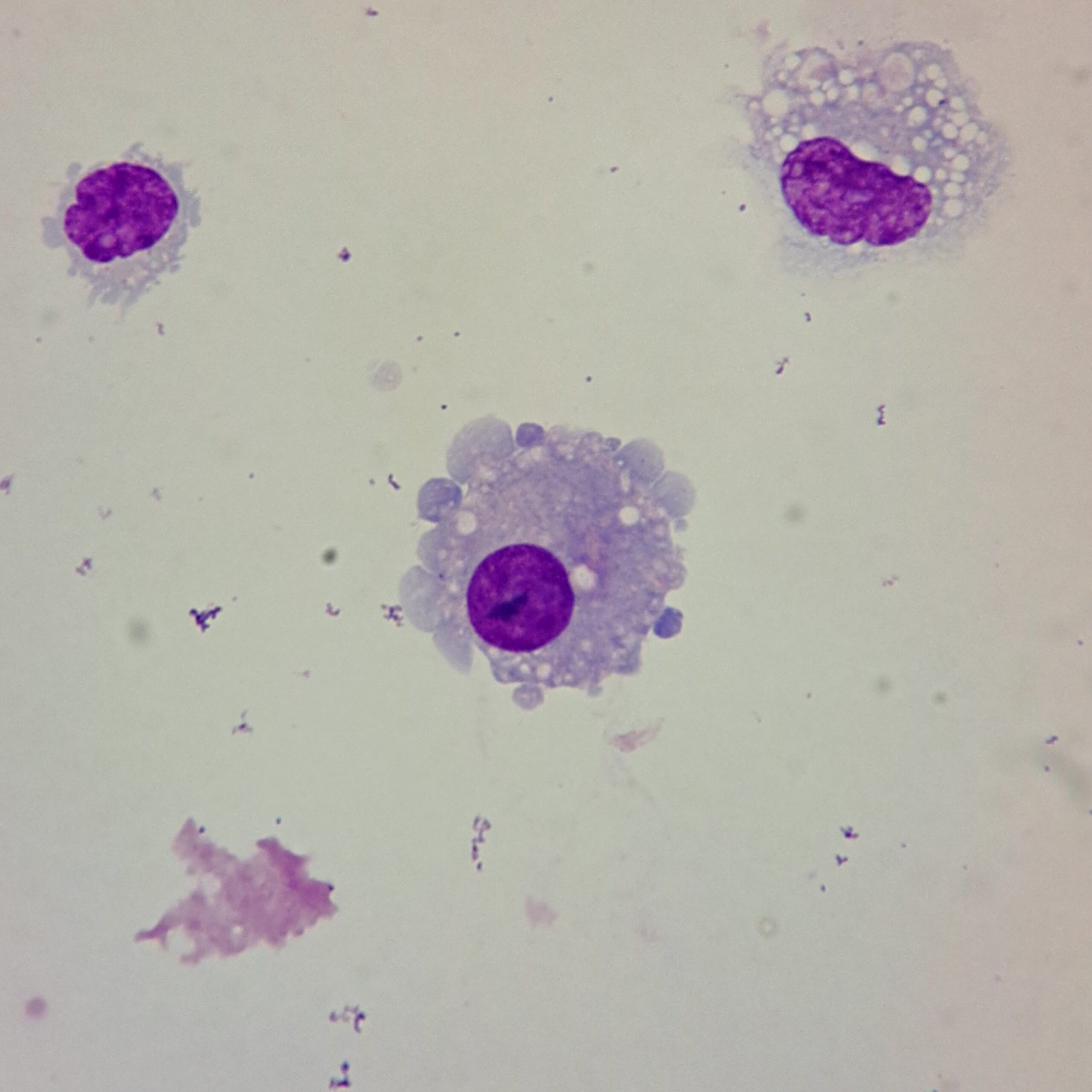 synovial lining cell (synoviocyte)