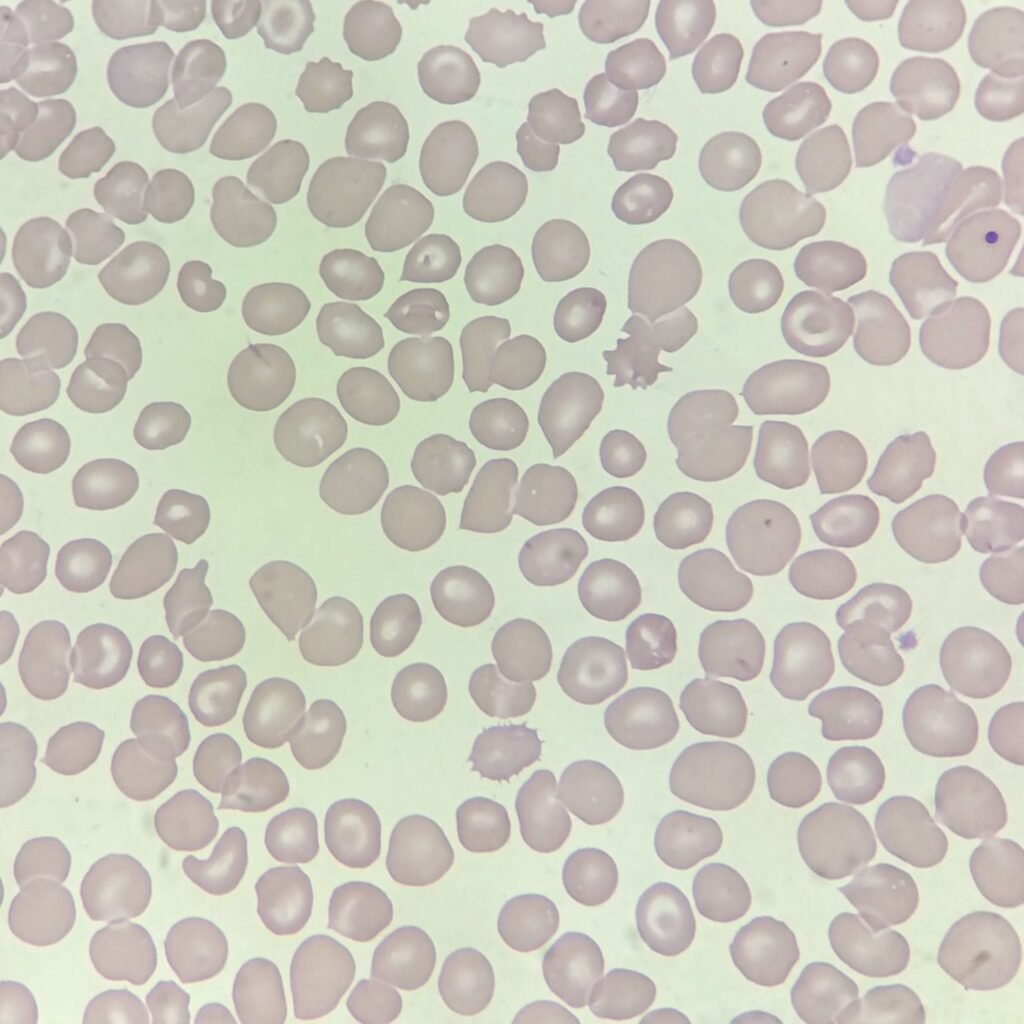 Target Cells (Codocytes)
