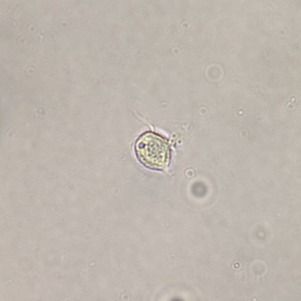 trichomonas in urine microscopic