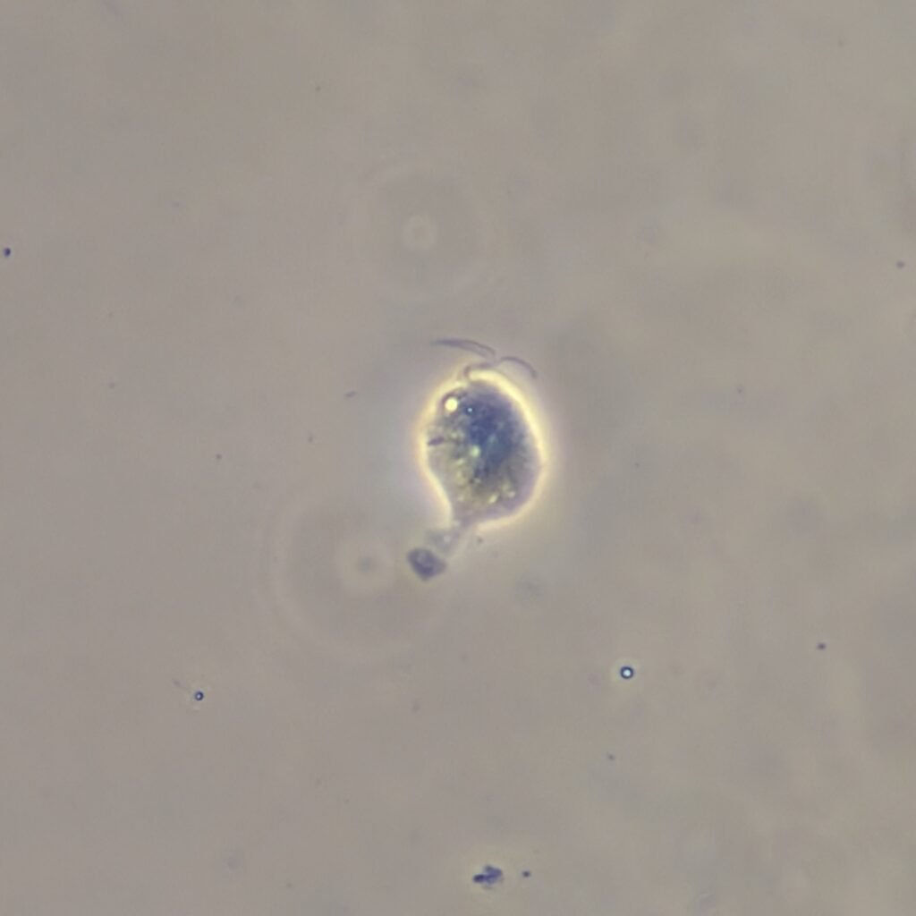 trichomonas in urine microscopic under phase contrast
