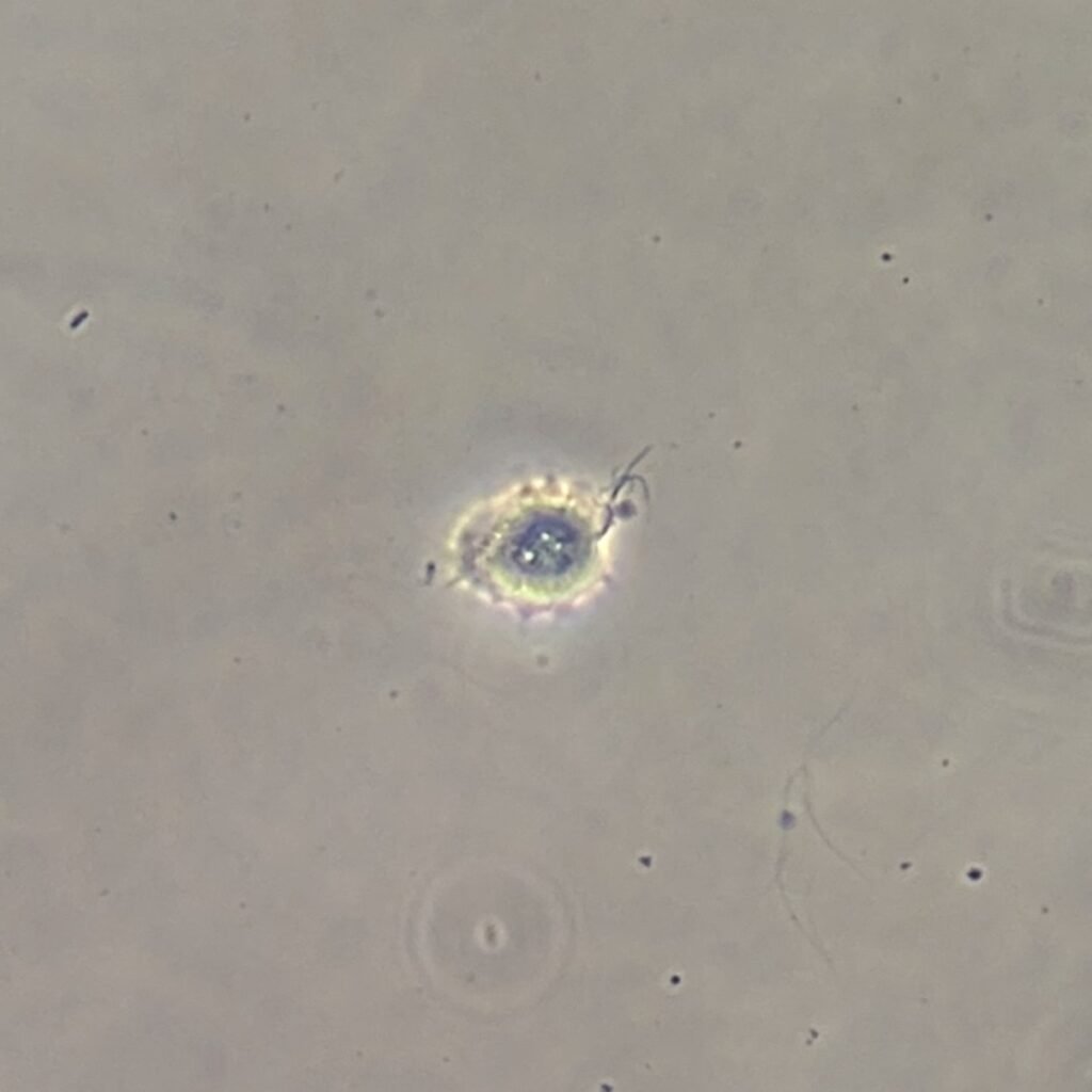 trichomonas in urine microscopic under phase contrast