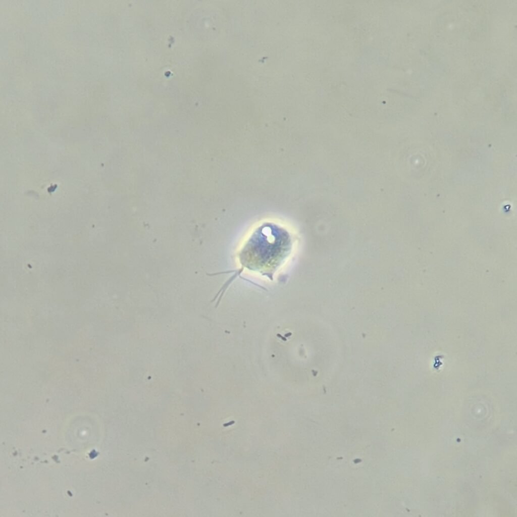 trichomonas in urine microscopic under phase contrast