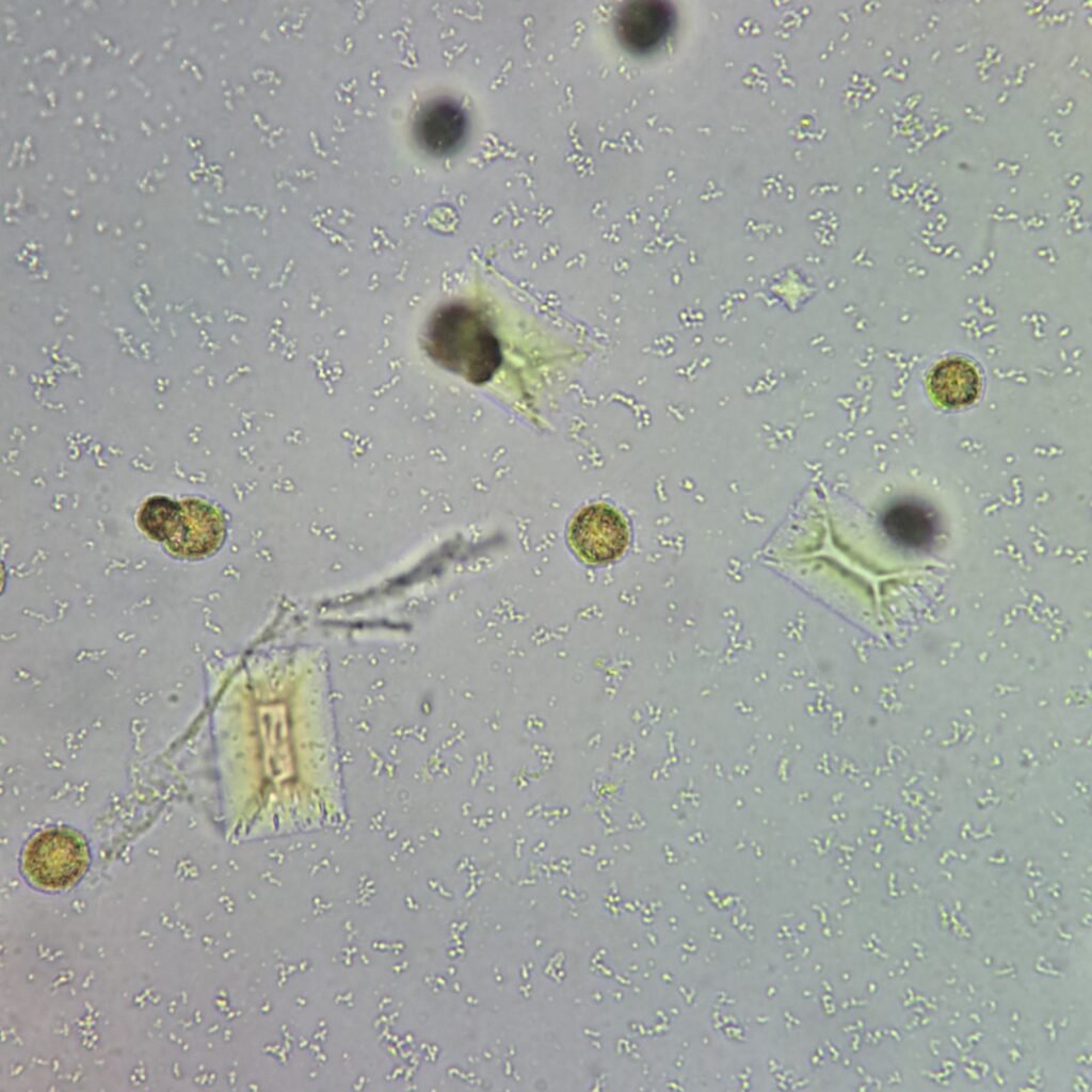 Triple Phosphate Crystals, Coffin Lid 