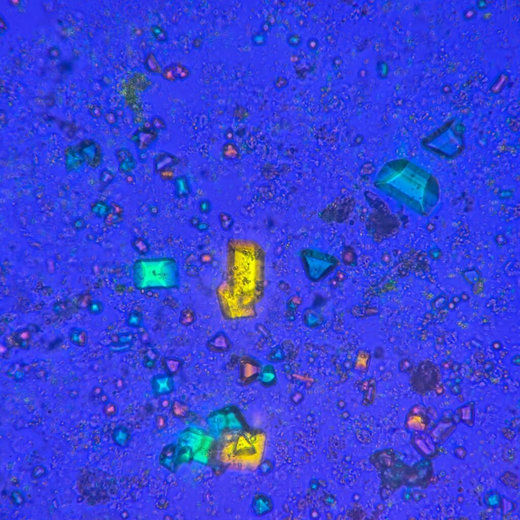 Triple Phosphate Crystals, Coffin Lid (Polarized)