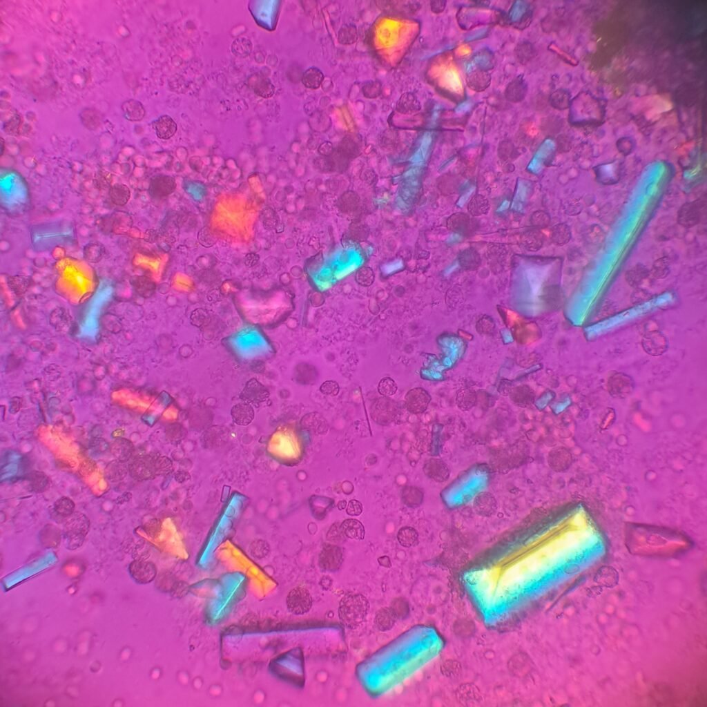 Triple Phosphate Crystals, Coffin Lid (Polarized)