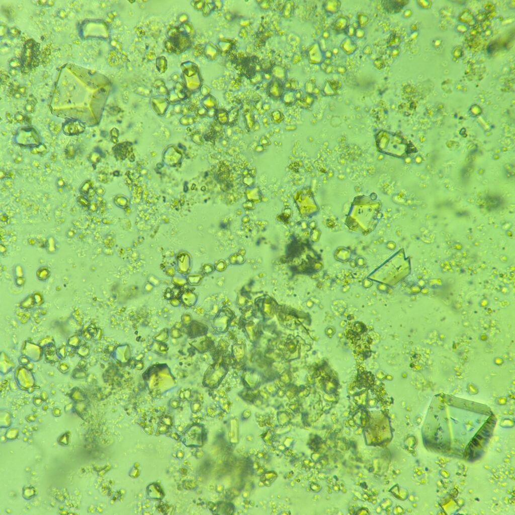 Triple Phosphate Crystals, Coffin Lid 
