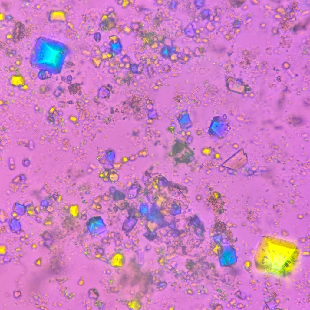 Triple Phosphate Crystals, Coffin Lid (Polarized)