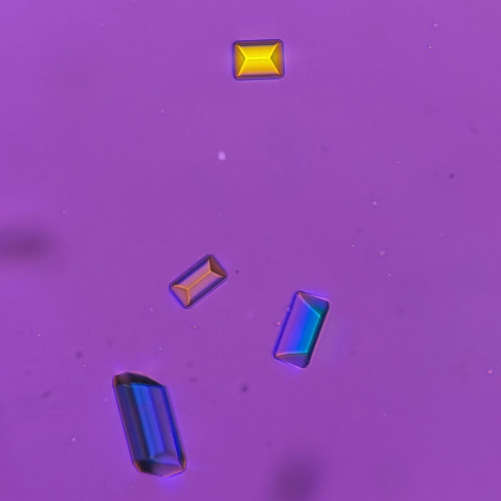 Triple Phosphate Crystals, Coffin Lid (Polarized)
