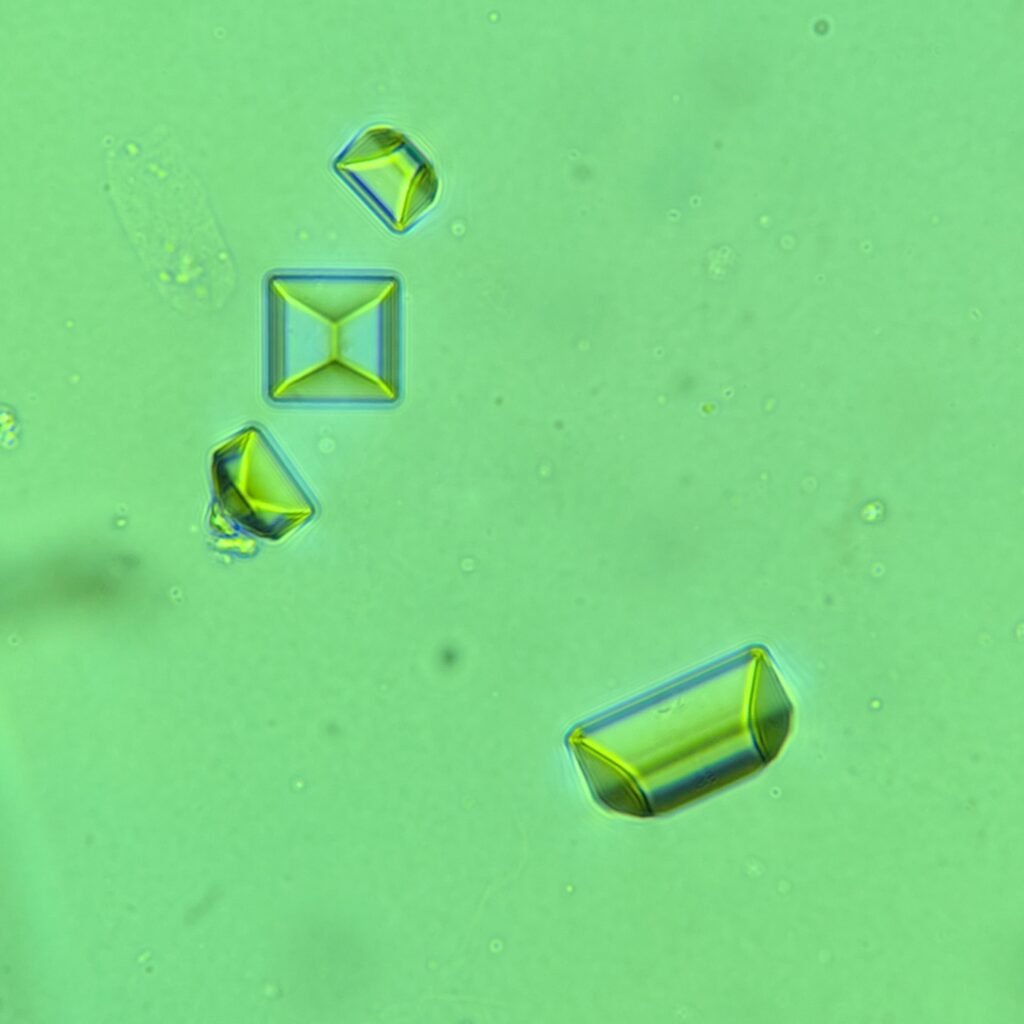 Triple Phosphate Crystals, Coffin Lid 