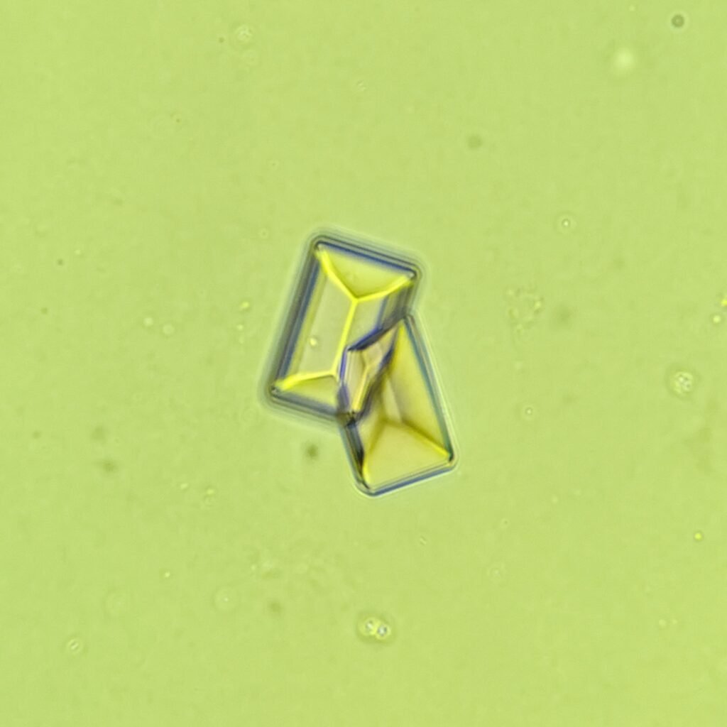 Triple Phosphate Crystals, Coffin Lid 
