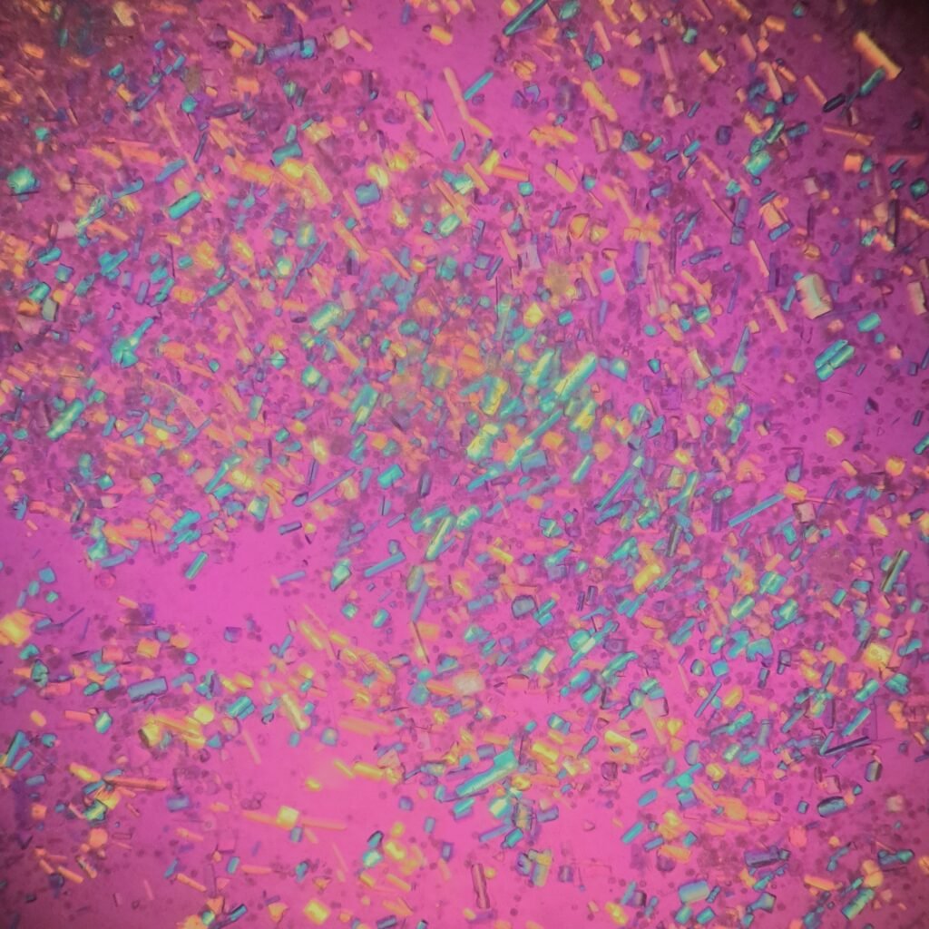 Triple Phosphate Crystals, Coffin Lid (Polarized)