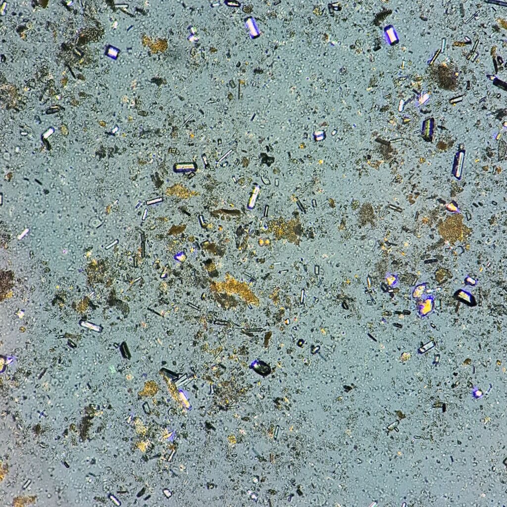 Triple Phosphate Crystals, Coffin Lid (Polarized)