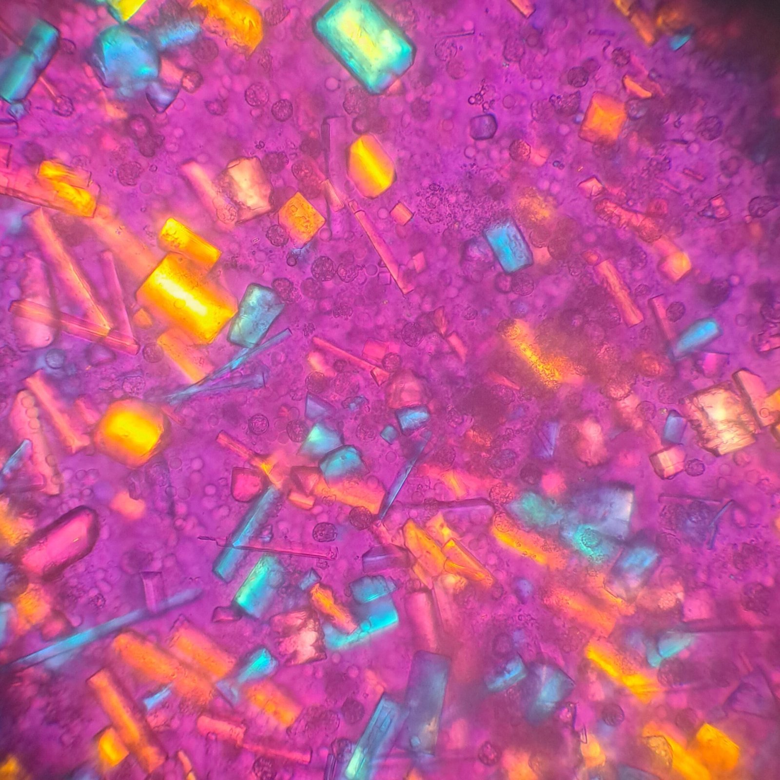 Triple Phosphate crystals in urine sediment, coffin lid, polarized