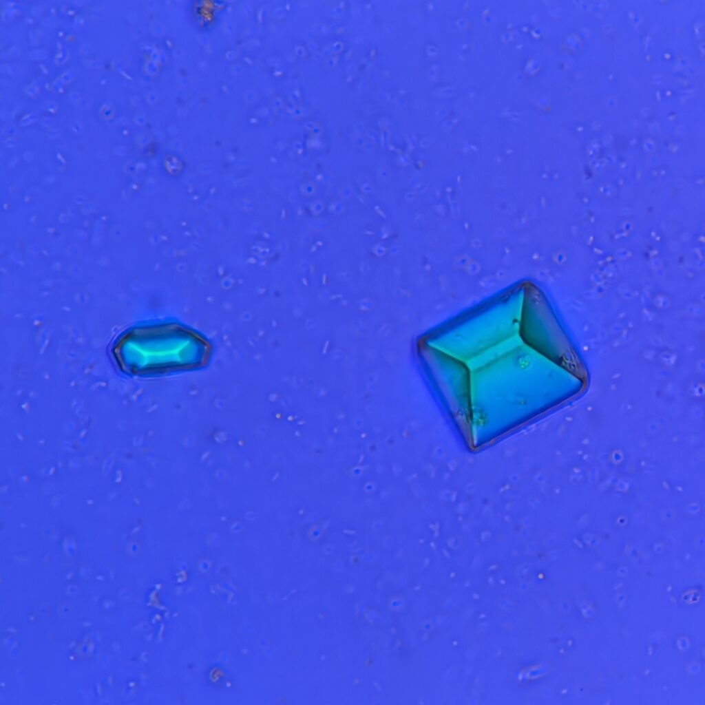 Triple Phosphate Crystals, Coffin Lid (Polarized)
