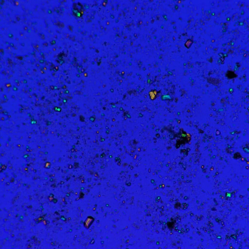 Triple Phosphate Crystals, Coffin Lid (Polarized)