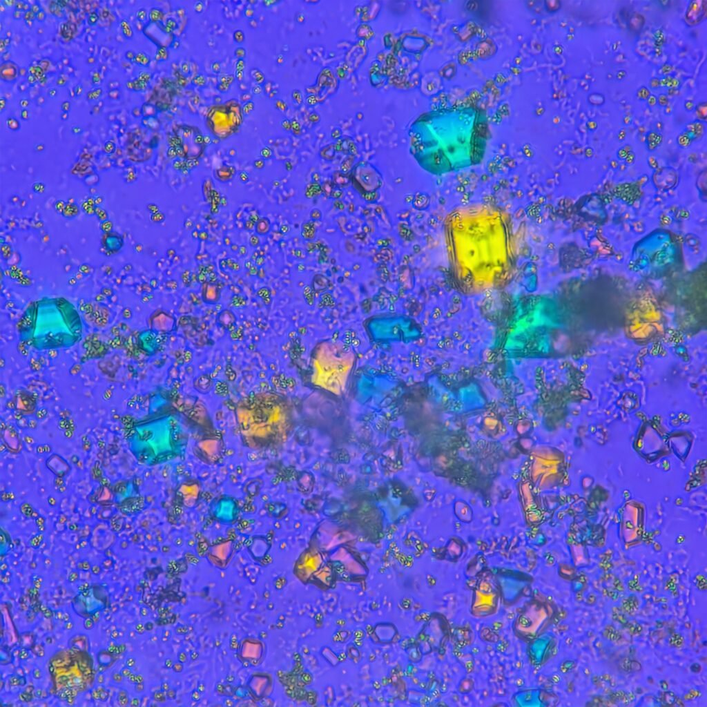 Triple Phosphate Crystals, Coffin Lid (Polarized)