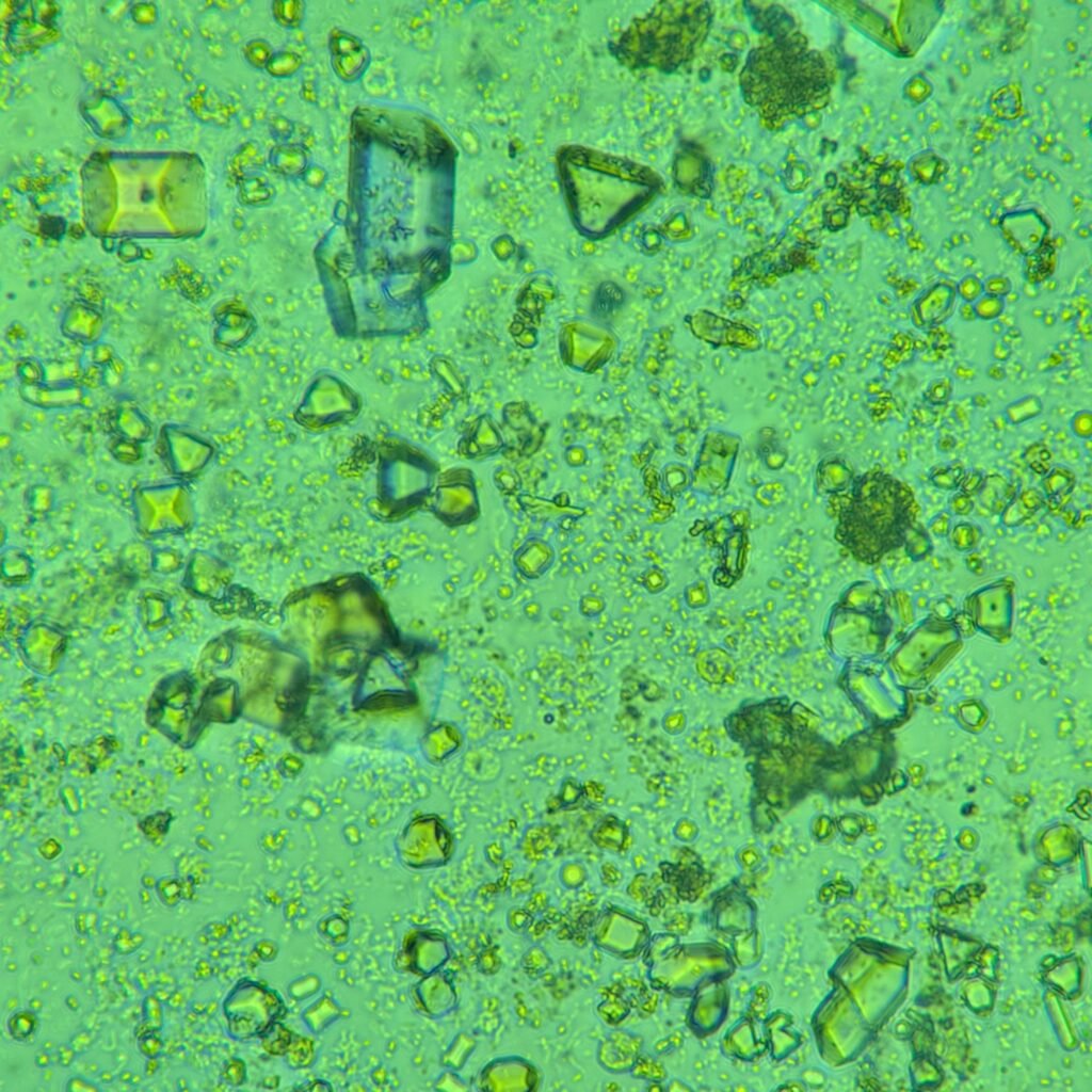 Triple Phosphate Crystals, Coffin Lid 