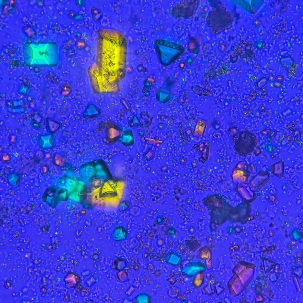Triple Phosphate Crystals, Coffin Lid (Polarized)