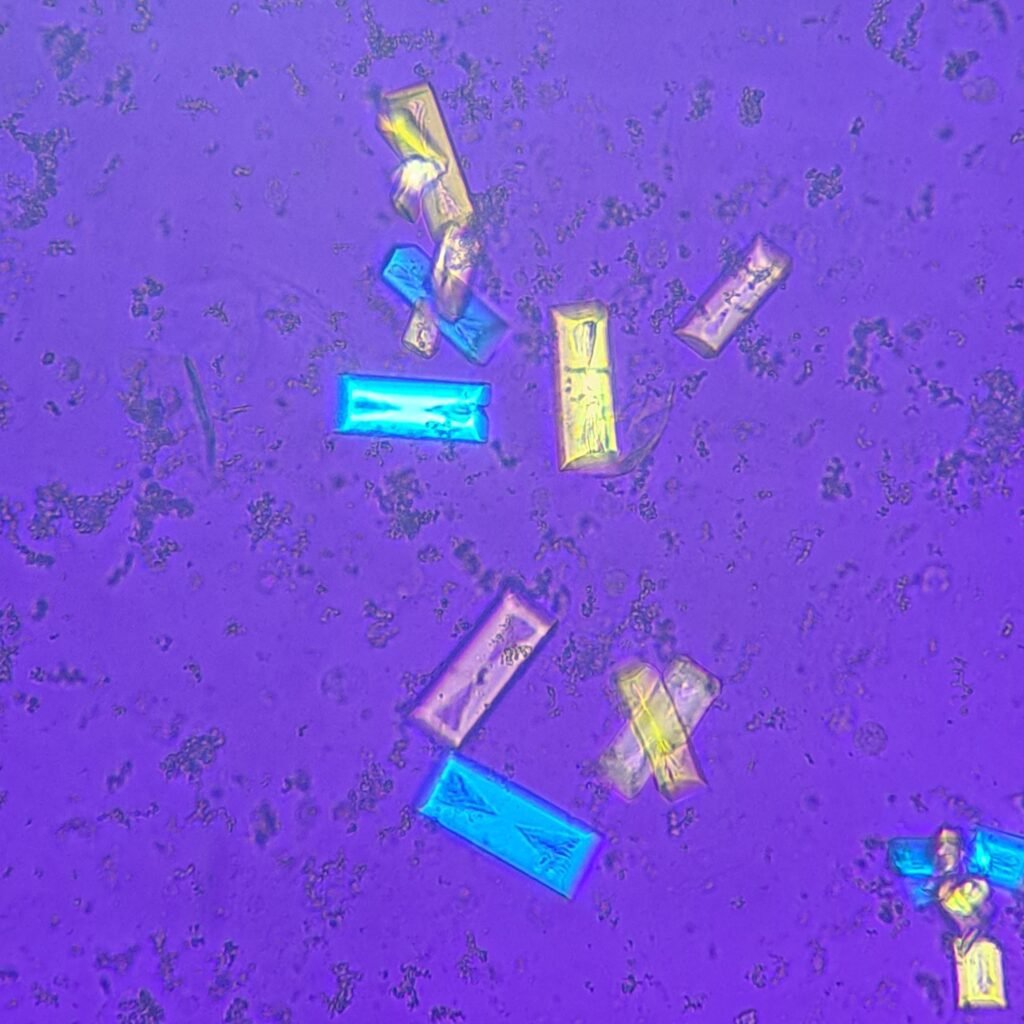 Triple Phosphate Crystals, Fern (Polarized)