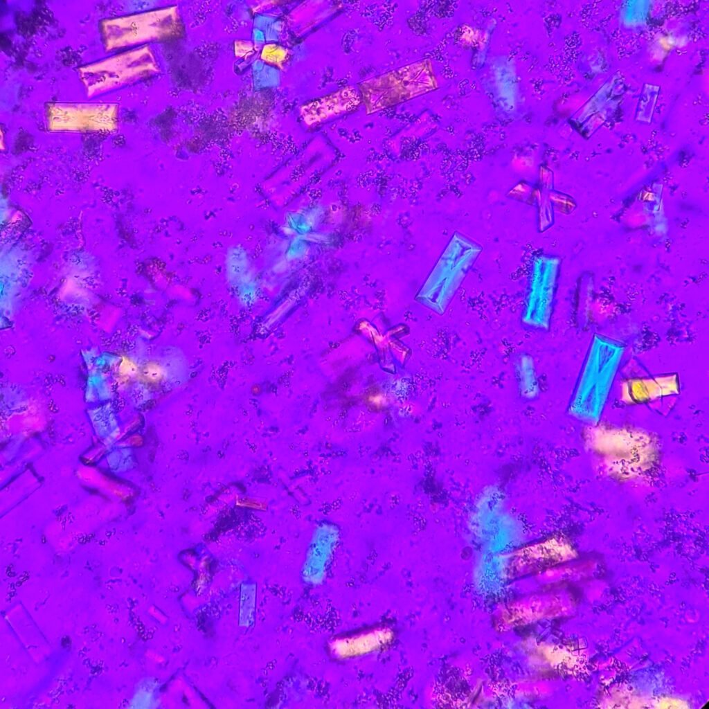 Triple Phosphate Crystals, Fern (Polarized)
