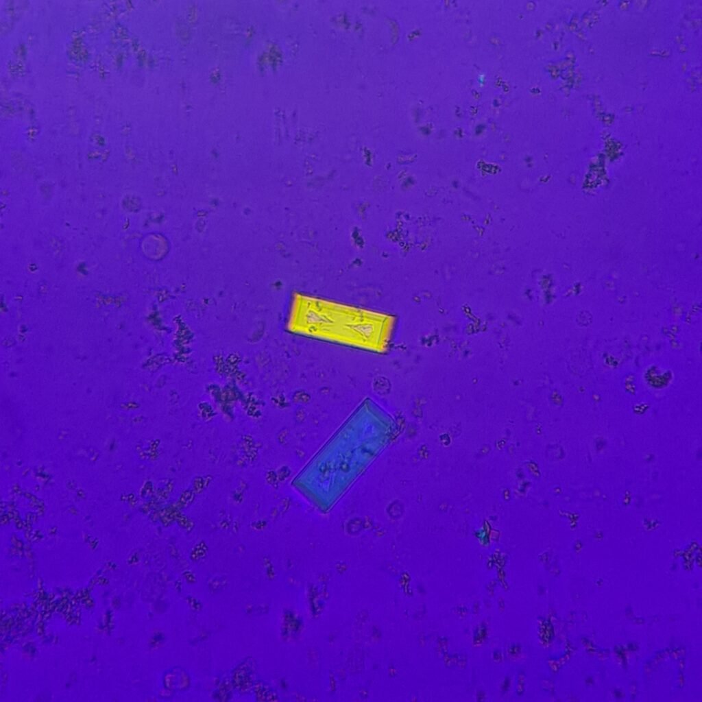 Triple Phosphate Crystals, Fern (Polarized)