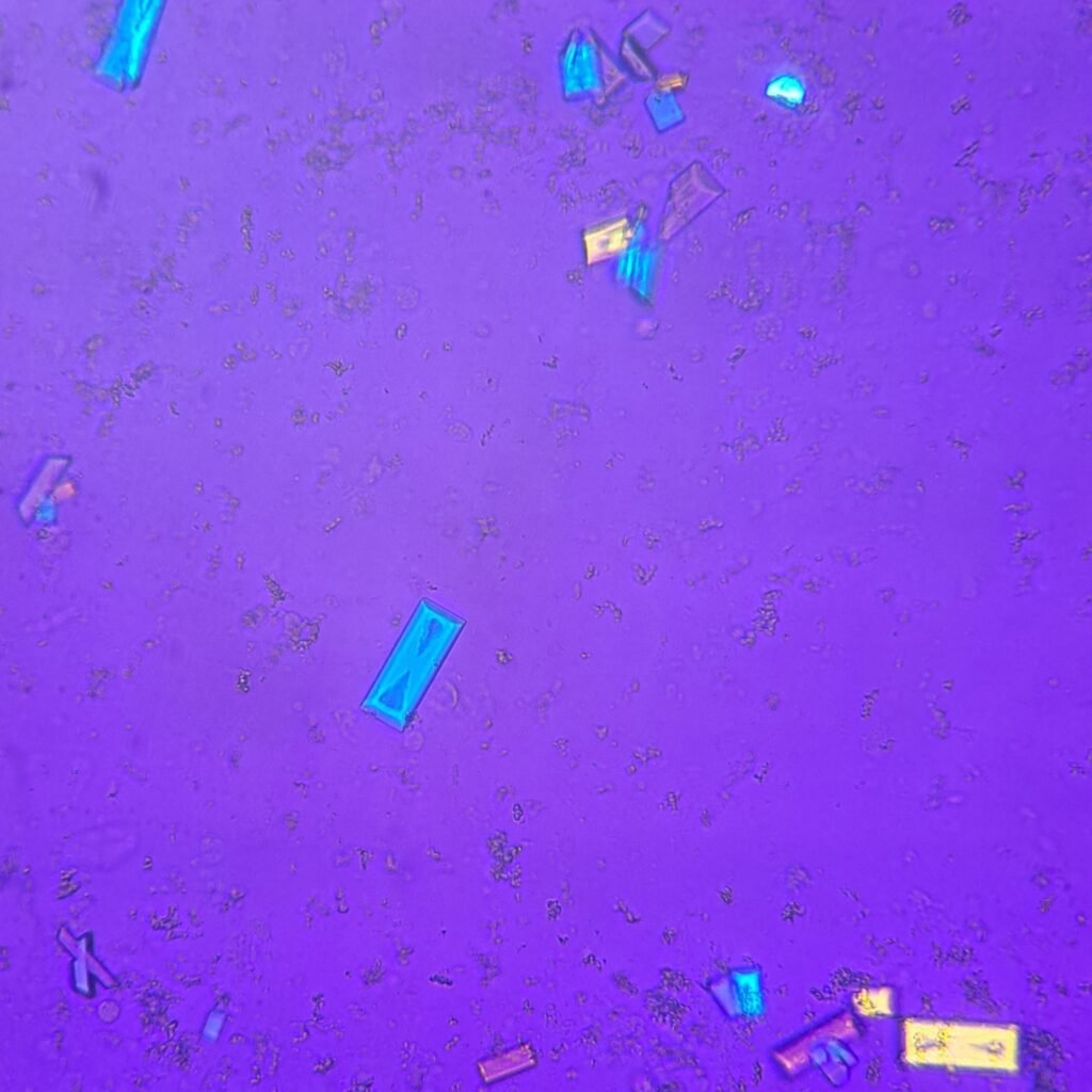 Triple Phosphate Crystals, Fern (Polarized)