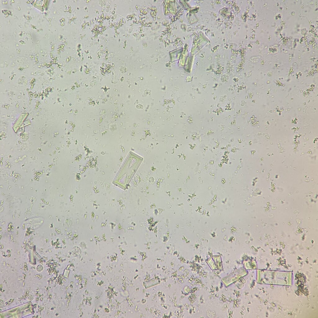Triple Phosphate Crystals, Fern