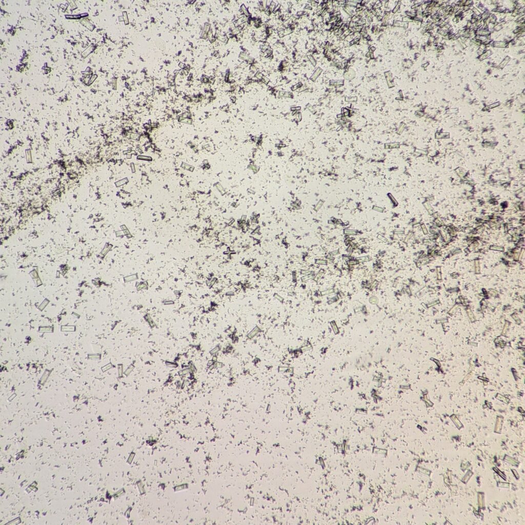 Triple Phosphate Crystals, Fern