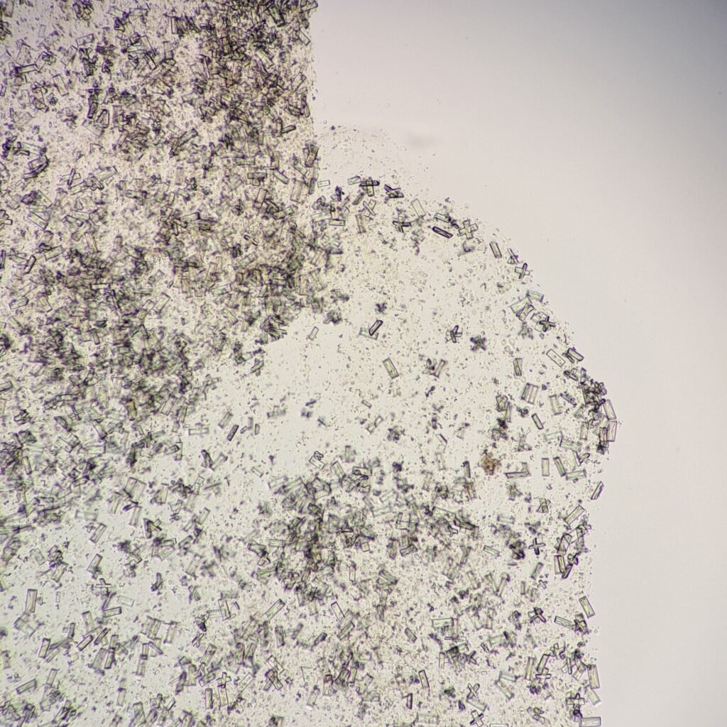 Triple Phosphate Crystals, Fern