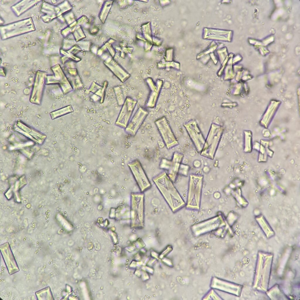 Triple Phosphate Crystals, Fern