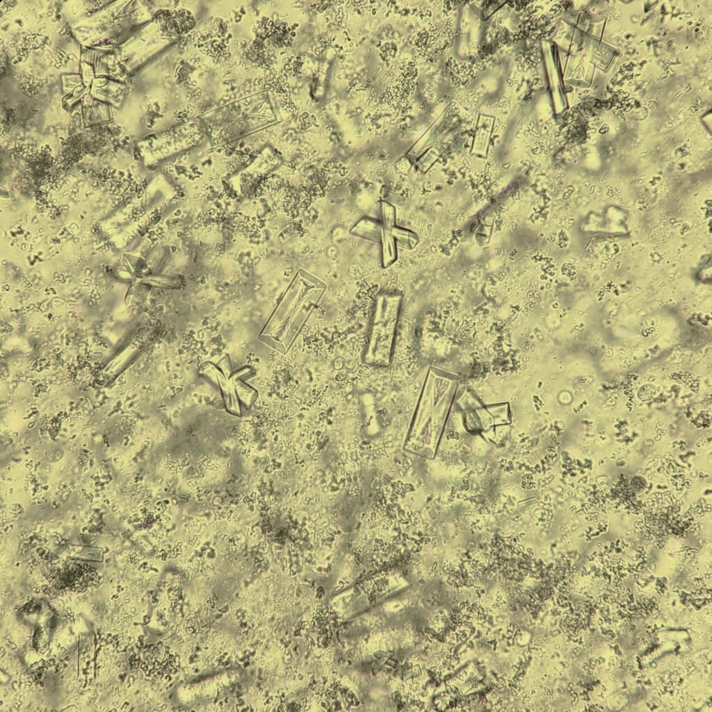 Triple Phosphate Crystals, Fern