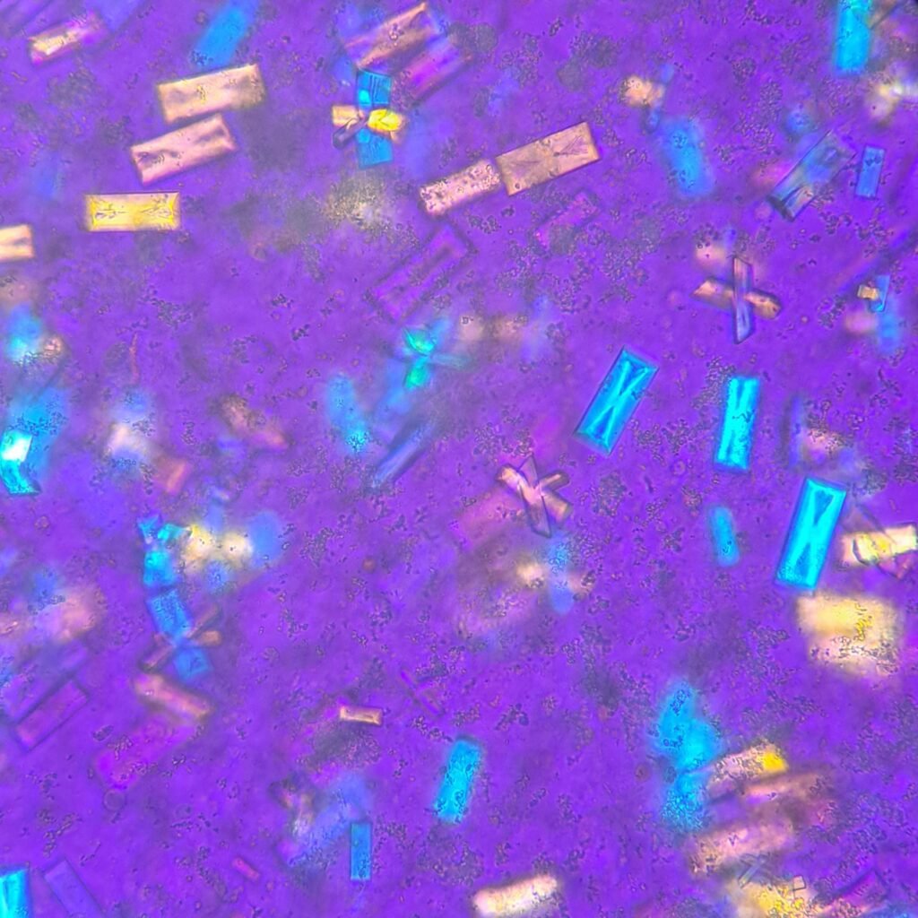 Triple Phosphate Crystals, Fern (Polarized)