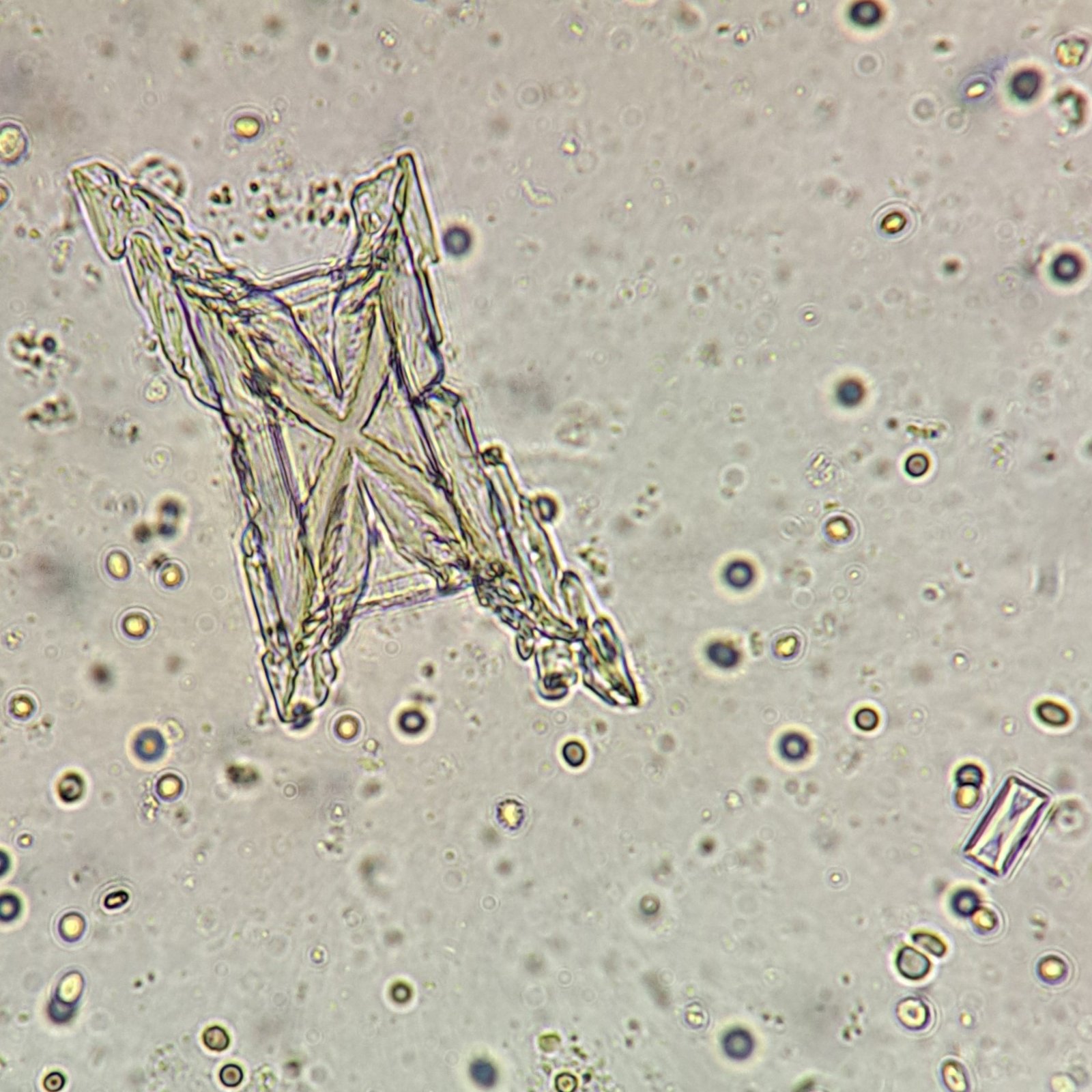 Triple Phosphate Crystals, Fern