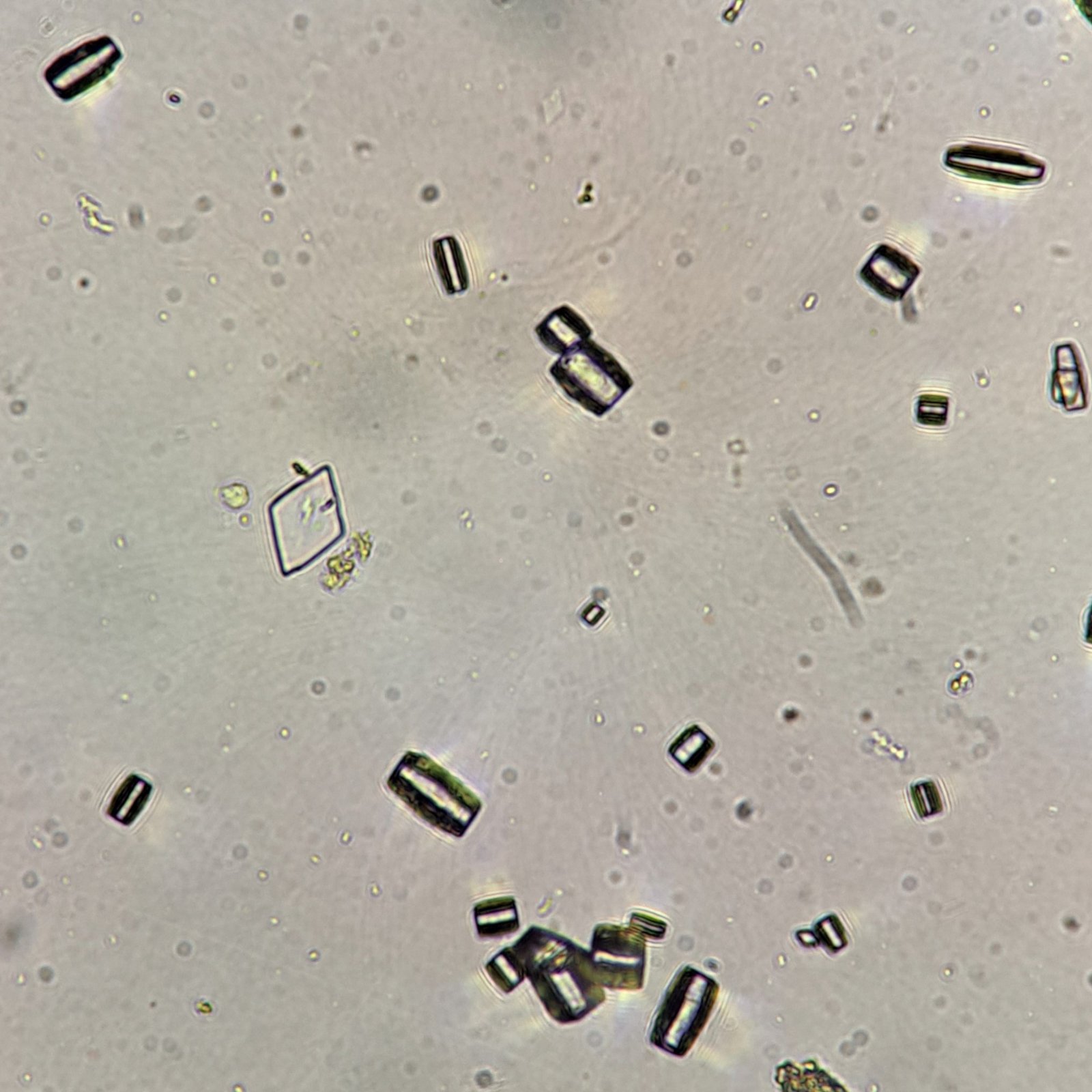 Uric Acid Crystals, Barrel & Diamond/Rhomboid Form