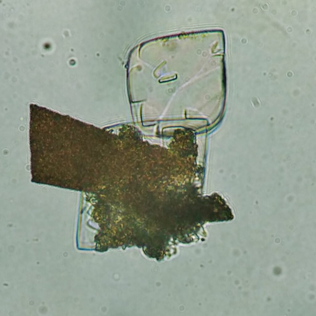 Uric Acid Crystals, Diamond/Rhomboid  & Rosette Form
