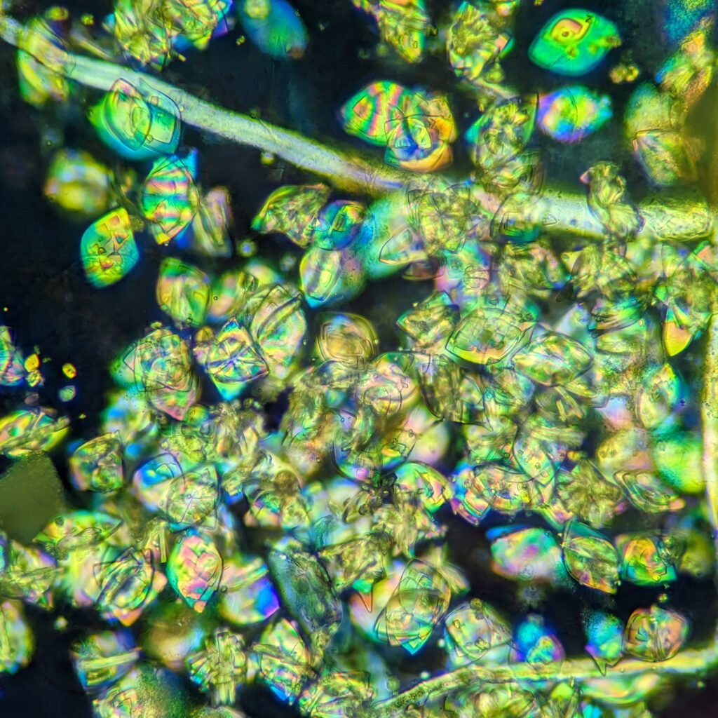 Uric acid crystals in urine, rhomboid, polarized