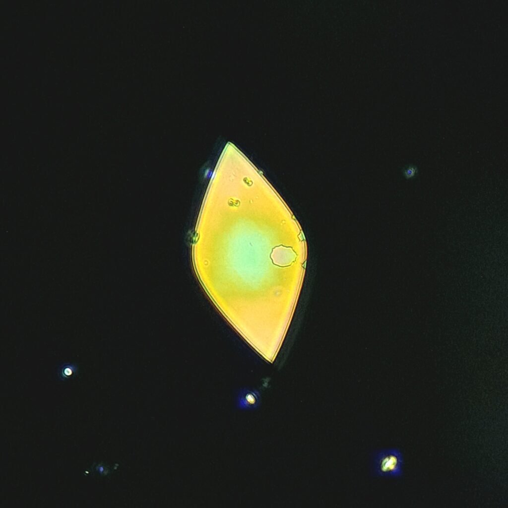Uric Acid Crystals, Diamond/Rhomboid Form (Polarized)