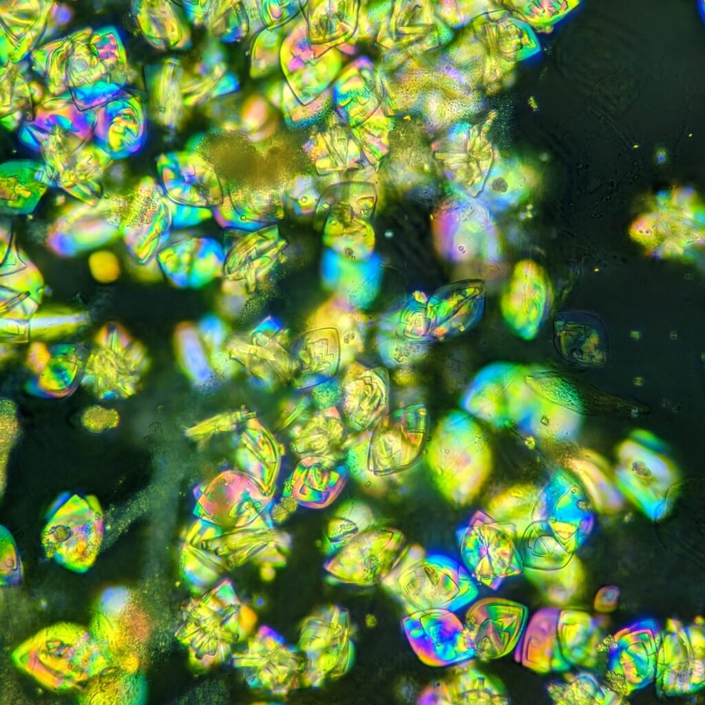 Uric acid crystals in urine, rhomboid, polarized