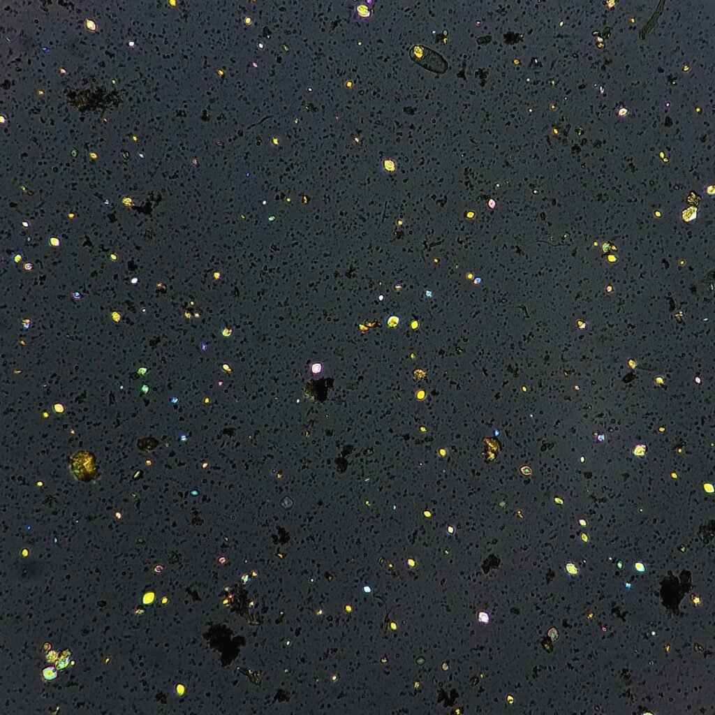 Uric Acid Crystals, Diamond/Rhomboid  & Rosette Form (Polarized)