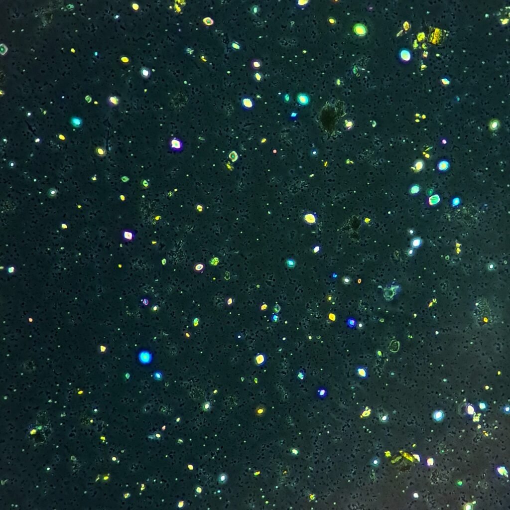 Uric Acid Crystals, Diamond/Rhomboid Form (Polarized)