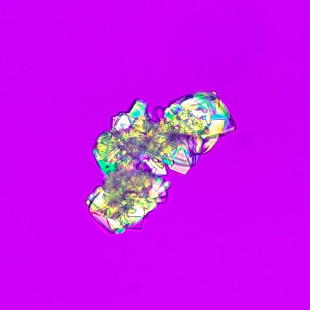 Uric Acid Crystals, Rosette Form (Polarized)